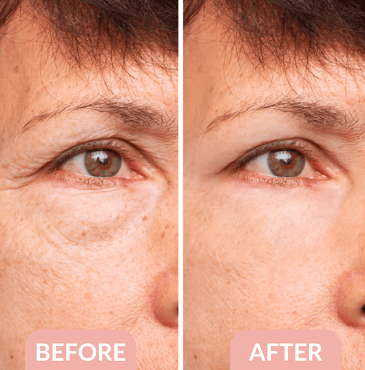 The Blissora FIRMx Collagen Infusion Eye Patches